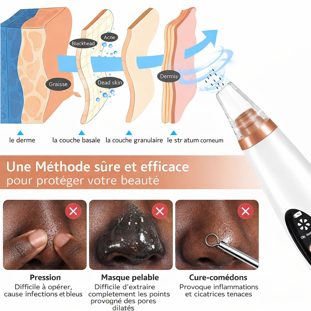 Aspirateur de Points Noirs Électrique – Nettoyeur de Pores Rechargeable USB