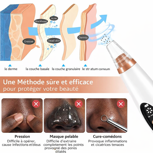 Aspirateur de Points Noirs Électrique – Nettoyeur de Pores Rechargeable USB
